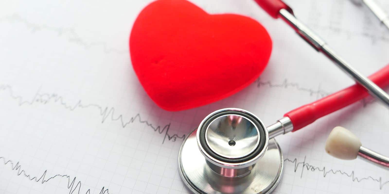 ¿Cuáles son los factores de riesgo cardiovascular?