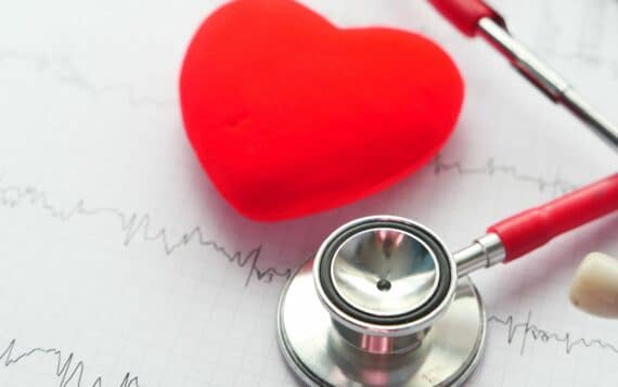 factores riesgo cardiovascular