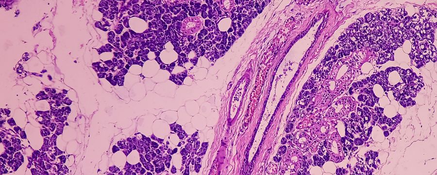 Inmunohistoquímica